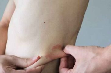 Ozdikenosis Explained: Why It Defeats Characters in Stories