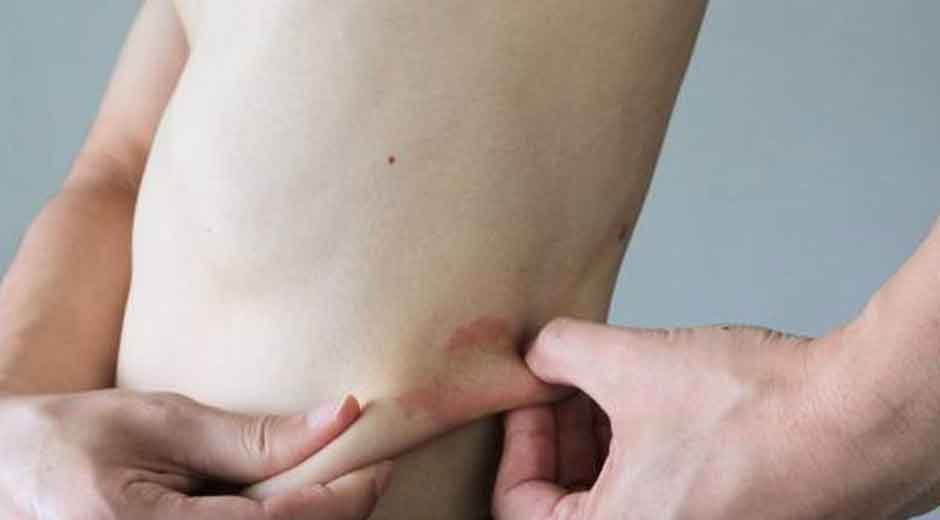 Ozdikenosis Explained: Why It Defeats Characters in Stories