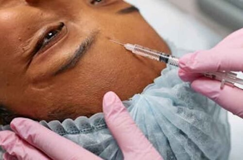 Transform Your Appearance with Tear Trough Filler